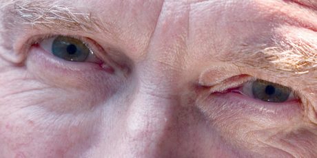 Glaucoma é o problema de visão mais comum entre os idosos