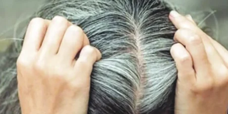 Por que os fios ficam brancos?